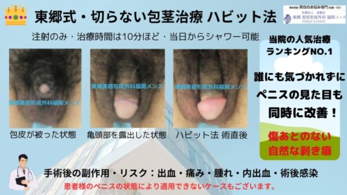 「切らない包茎治療　東郷式・ハビット法について」症例写真更新中