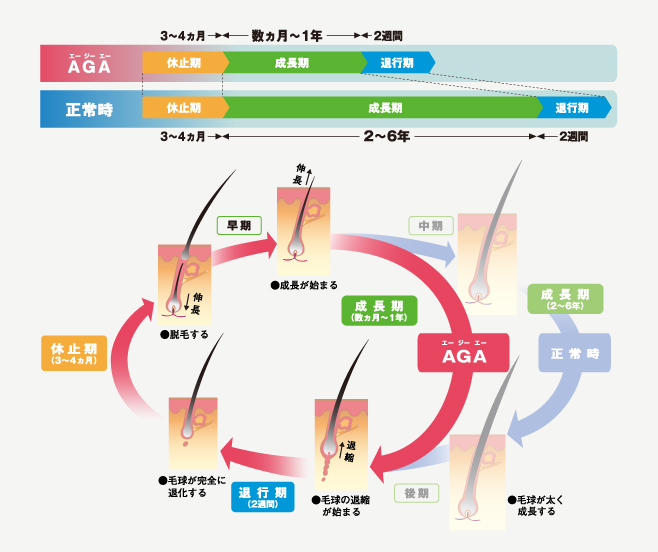 ヘアサイクル 薄毛 宮崎
