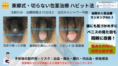 切らない包茎治療　福岡市中央区