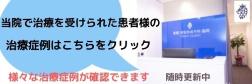 ICI注射 福岡博多