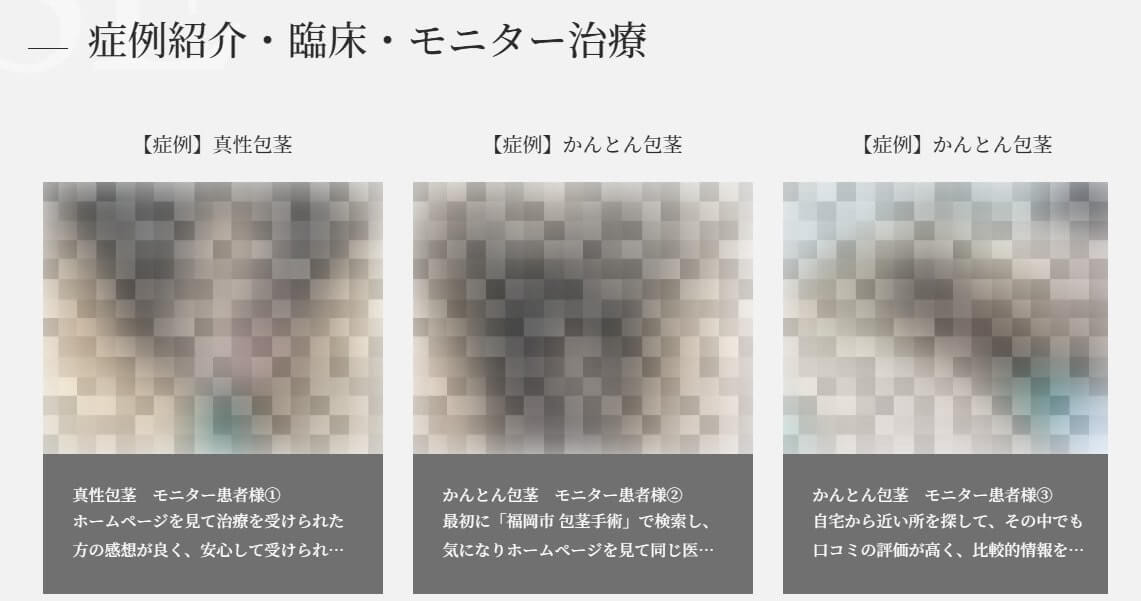 包茎モニター写真