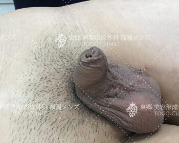 臨床写真 術前の状態2