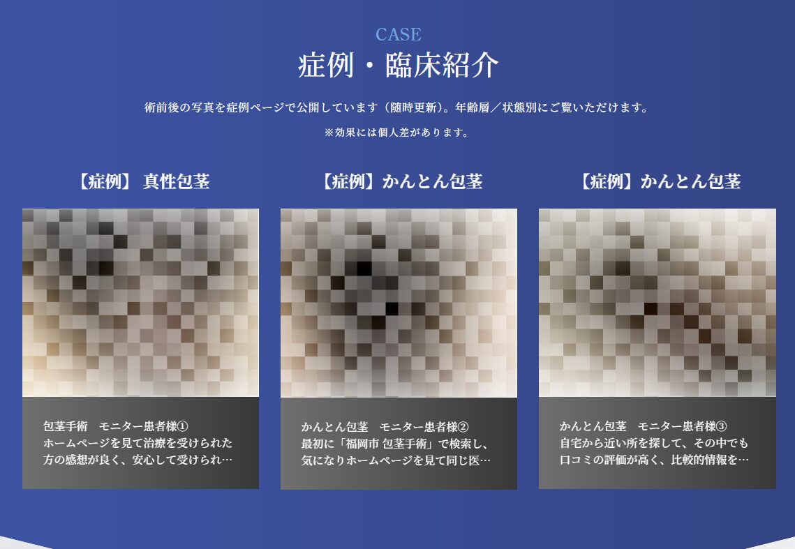 包茎手術　臨床写真